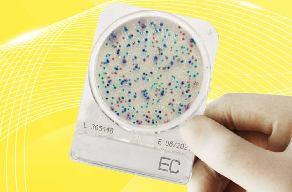 Compact Dry – найсучасніший мікробіологічний контроль (відео)